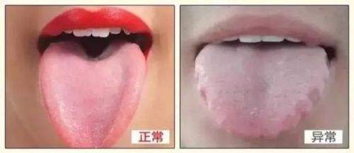湿气重的表现症状，该怎么快速调理？ 