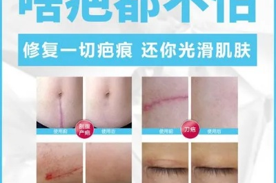 去疤痕最好的方法是什么？这几招太震撼了，亲测 