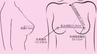做丰胸手术需要多少钱呢 