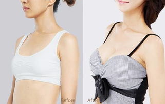 女生怎么丰胸最有效果 