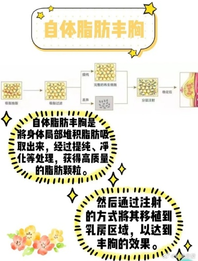 填充自体脂肪丰胸多少钱 